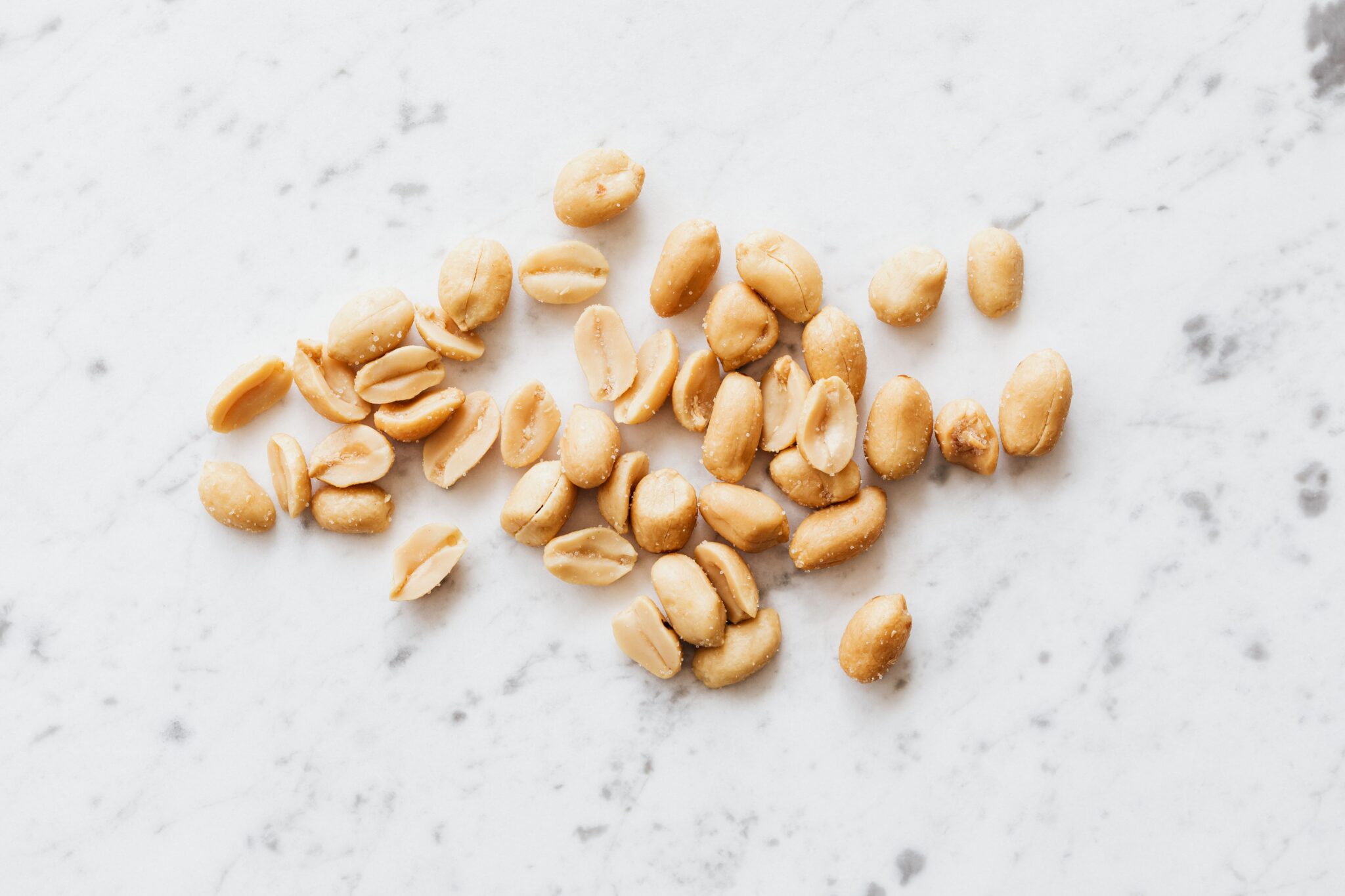 Food allergies in children